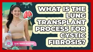 What Is The Lung Transplant Process For Cystic Fibrosis? - Cystic Fibrosis Health Hub