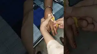 How To Remove IV Set From Cannula. IV Set Kaise Nikale Cannula se#shorts