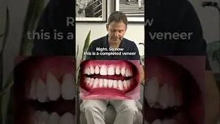 🦷 Mastering Veneer Preparation: Key Techniques for Perfect Smiles!