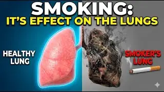 Smoking: It's effect on the lungs