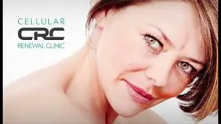 Stem Cells for Skin Regeneration