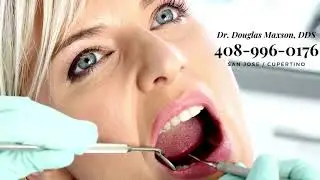 Douglas R Maxson San Jose Dentist
