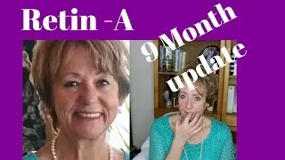 Retin A - Tretinoin 9 Month Update Before and After Pics | Monika's Beauty & Lifestyle