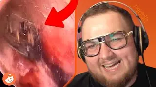 MÁ V UCHU PAVOUKA!