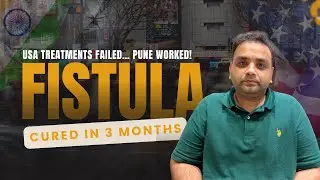 USA to Pune: How DLPL Surgery Cured His Fistula in 3 Months!