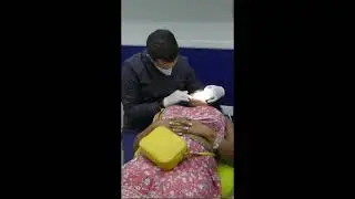 Smile Makeover Magic ✨ | Real Patient Transformation