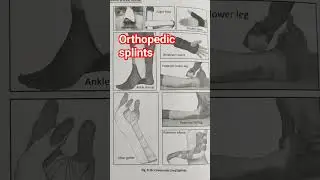 #orthopedic splints #shorts #msn second year ll #nursing 🔥🔥🔥🔥🔥