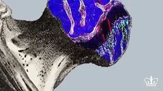 Bone stem cells shown to regenerate bone and cartilage in adult mice