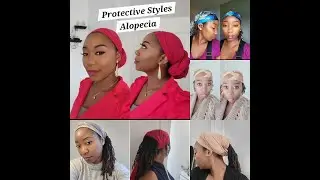 How I Rock My Locs and Conceal Alopecia with Scarves & Headbands | Androgenetic Alopecia | CCCA