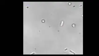 Bacteria E. Coli manipulation with optical tweezers.