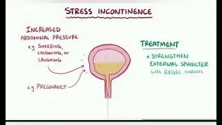 incontinence causes, symptoms, management 24/September/2024