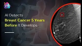 Detecting Breast Cancer with Machine Learning! #podcast  #artificialintelligence #machinelearning