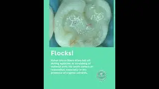 ZerofloX: flock free
