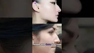 Roman Nose