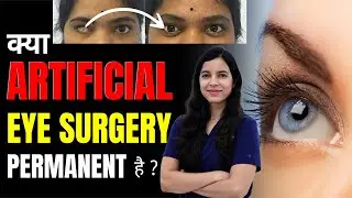 Is artificial eye surgery permanent? | Is artificial eye surgery permanent hindi | Dr Anamika Joshi