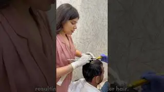 PDO Hair Thread Treatment for Hair Growth & Scalp Rejuvenation | Paradise Wellness Clinic, New Delhi
