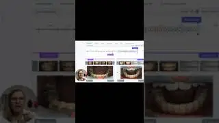 What To Do When Teeth Come In Late With Braces... | Invisalign and Braces Orthodontist | Houston, TX