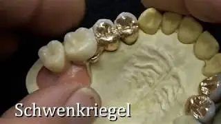 Schwenkriegel