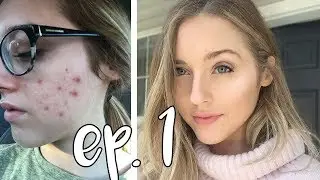 FOUNDATION ROUTINE for acne prone skin | Episode 1