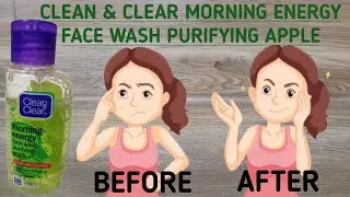 #Clean and clear face wash review