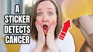 Can A Sticker Detect Melanoma Skin Cancer?