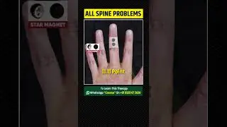 Acupressure Points For All Spine Problems