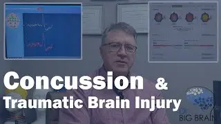 How Neurofeedback Therapy Helps Treat Concussion & Traumatic Brain Injury