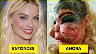 &iexcl;15 famosas famosas que destruyeron sus caras con cirug&iacute;a pl&aacute;stica! | | entonces y ahora 2026