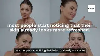 Microneedling in Dallas, TX: Before and After Results