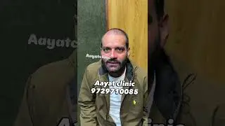 Hair Transplant Result After 1 Month | Patient Honest Review | Dr Shahid Mirza #hair #haircare