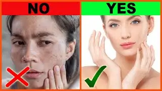 5-Minute Dark Spots Removal | Remove Black Spots on Face at Home Fast | DIY Skin Whitening Routine