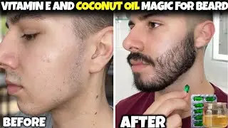 Evion 400 and coconut oil for beard growth | beard growth tips | vitamin e capsules for beard growth
