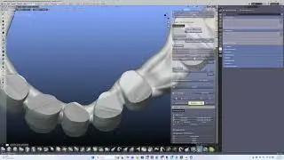 Crowns- regenerate a bridge after it has been completed.
