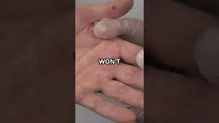 Why Your Fingers Wrinkle in Water
