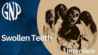 Megaa from Swollen Teeth Interview | Talking about Ask Nothing