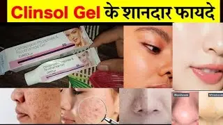Clindamycin Phosphate and Nicotinamide Gel ke fayde ll Benefits of clincol gel ll