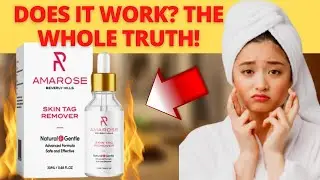 IMPORTANT ALERT! My Honest Amarose Skin Tag Remover Reviews- Does Amarose Skin Tag Remover Work?!