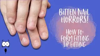 Bitten Nails | Form and Tip Fitting | INK London