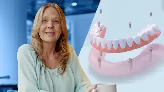 Can Dental Implants Be Completed In a Single Day?