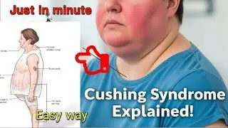 Cushing syndrome in just one minute ❤️#nursingzone #nursing #medicallectures #mbbs 