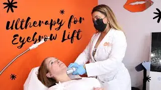 Ultherapy For Eyebrow Lift | VIP Laser | Miami