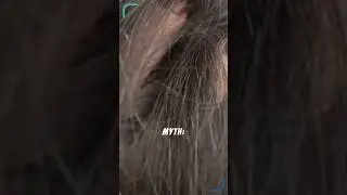 Why Your Hair Turns Gray (It&rsquo;s Not Just Age!)