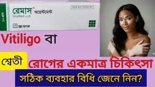 Remus Oinment ব্যবহারে Vitiligo (শ্বেতী রোগ ) কি ভালো হবে ? ব্যবহারের নিয়ম জেনে নিন?#Vitiligo#শ্বেতী