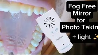 Fog Free Dental Photography Mirrors Review🌫