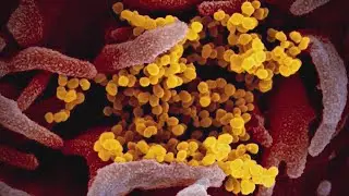 Coronavirus deaths may be decreasing but nation sets record on new cases