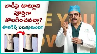 టాటూ ని తొలగిస్తే ఏమవుతుంది? | Tattoo Removal | Permanent Tattoo | Solution | Side Effects | Sriroop