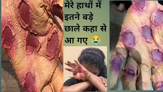 SFX makeup tutorial wounds!! Beginner friendly makeup tutorial 🔥!! #youtubevedeo #makeup