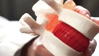 Herniated Disc - Advanced Wellness in Freehold and Marlboro NJ