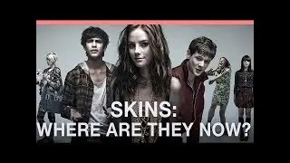 THE CAST OF SKINS THEN AND NOW