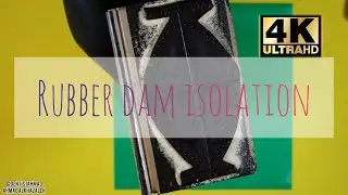 Rubber Dam Isolation, retaining, and removal: step-by-step demonstration